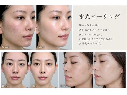 エムアイ 六本木(Mi)の写真