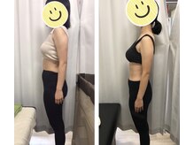 くまがい整体院 若松店/しっかりサイズダウンコース