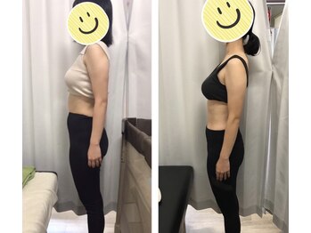 くまがい整体院 若松店/しっかりサイズダウンコース