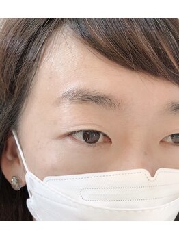 デュカ(Duca)/T様　眉before