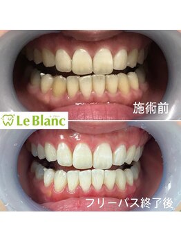 ルブラン 奈良店(Le Blanc)/歯を見せて笑えていますか?