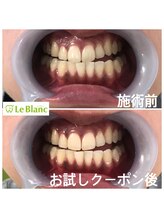 ルブラン 奈良店(Le Blanc)/自分へのご褒美、プレゼントに