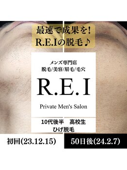 レイ(R.E.I)/ひげ脱毛／10代後半／ひげ普通