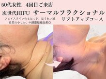 エクストリミティ 国立店(EXTREMITY)の雰囲気（最新リフトアップと高い技術力でエイジングサインを解消◎）