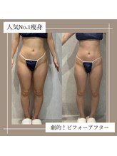 アーネスト 夙川店(EARNEST)/比較写真