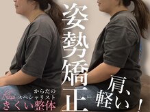 きくい整体院/腰痛 骨盤矯正 肩こり 猫背矯正