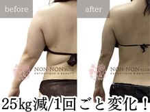 ノンノンプラス 博多(NON-NONプラス)