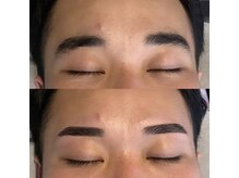 マスター アイブロウ(MASTER EYEBROW)/困り眉改善