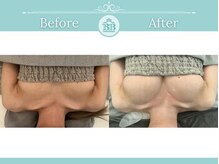 美人バスト 新潟店/ 【バストアップ★育乳】症例