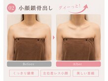 モアフェイス 池袋店(More Face)/小顔矯正　左右差矯正　鎖骨矯正