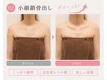 モアフェイス 池袋店(More Face)/小顔矯正　左右差矯正　鎖骨矯正