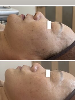 Rety Body&Facialの写真/フェイシャルとヘッドメニュー有！デコルテから首肩まで丁寧に整え、種類豊富なパックで素肌美を目指す☆