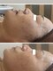 Rety Body&Facialの写真/フェイシャルとヘッドメニュー有！デコルテから首肩まで丁寧に整え、種類豊富なパックで素肌美を目指す☆