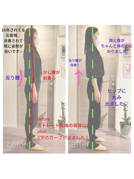 アムリタ ラボラトリー/猫背整体背骨リメイク　姿勢改善