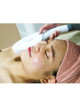 顔脱毛がしたい