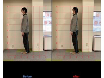 けいのき鍼灸整骨院/姿勢から身体を楽に!整体/肩こり