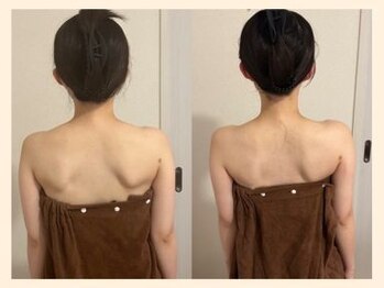 ラフリー 大阪梅田(RUFFREE)/【大阪梅田整体】肩甲骨はがし