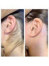 サロンアンドスクール ローズマリー (Salon&School Rosemary)/画期的ブラジリアンワックス脱毛