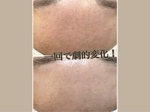ウェリナポノビューティサロン(welina pono beauty salon)/《小顔/毛穴/脱毛》