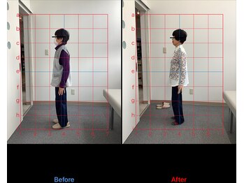 リード整骨院(LEAD整骨院)/肩こり/頭痛/ストレートネック