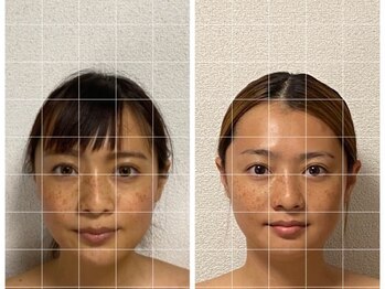 サロン アモル(salon amor)/ドライヘッドスパ＆インディバ