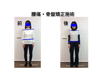 ジャンプ(Jump)/腰痛・骨盤矯正・トレーニング