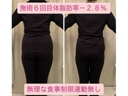 ヨサパーク ビープラス(YOSA PARK B+)の写真