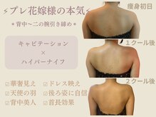 エステティックサロン アールグレー 名古屋駅店/背中二の腕引き締め/2クール12回