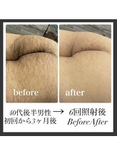 エリクサー 加須店(Elixir)/剛毛さん大歓迎！