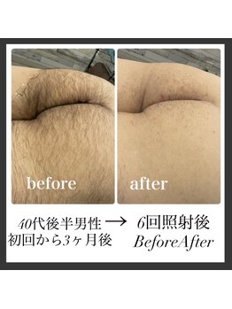エリクサー 加須店(Elixir)/剛毛さん大歓迎！