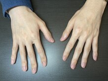 桃の木 吉祥寺店/メンズの綺麗な手2