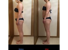 サロン シエラ/施術5回　30代