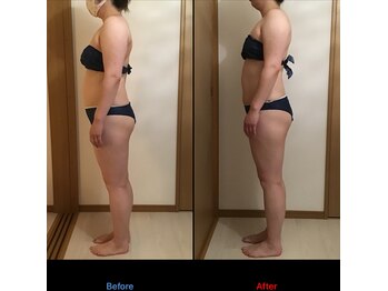 サロン シエラ/施術5回　30代