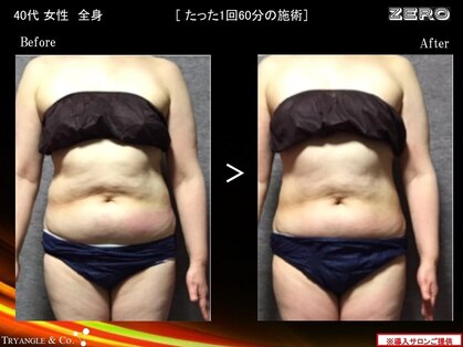 エステサロン ジュレ(JuRER)の写真