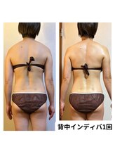 ランネル(Runnel)/インディバビフォーアフター♪