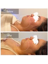 ウィズ ユー ビューティ(with U beauty)/フェイスライン変わりました