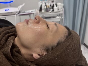 じぶんniプラスの写真/【エイジングケア美肌トリートメント15400円→8800円】トラブル知らずのお肌をGET♪憧れの水光肌に★