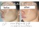 パールホワイトニングの写真