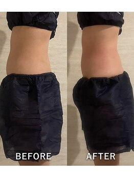 オーロラ(Aurora)/痩身ダイエットコースの1回目