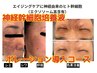 【当店人気No.1】神経&脂肪幹細胞導入液ポレーションコース¥12000⇒¥11000