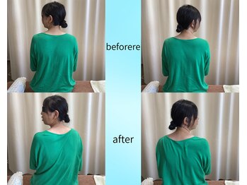 かみしな接骨院/可動域が改善！