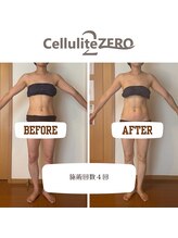 メリッサ(Melissa)/気になる部分を整える