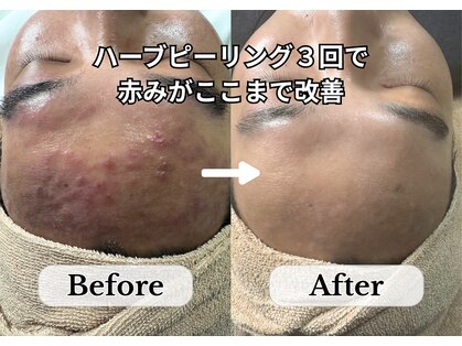 オーシャンハーブ(Ocean Harb)の写真