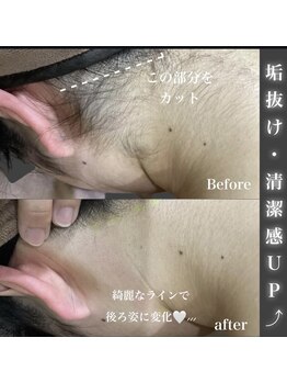 エステティック レイビス 八戸店(RAYVIS)/垢抜け・清潔感UP！