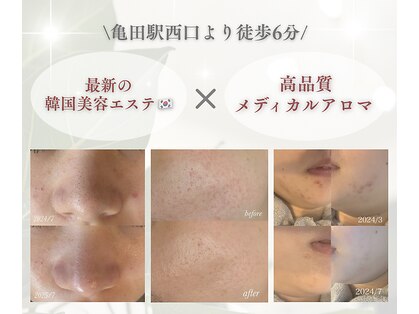 イルー(ILuu)の写真