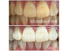 ホワイトニングルーム 横浜店(Whitening Room)/セルフホワイトニング/横浜