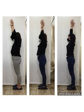 みつき鍼灸整骨院/【茨木市】初回→3ヶ月→1年