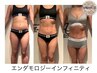 【人気No.1】AI最新痩身エンダモロジーInfinity全身60分むくみサイズセルケア