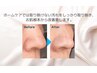 【毛穴洗浄が大人気♪】毛穴ハイドロスプラッシュピーリング(フェイシャル)