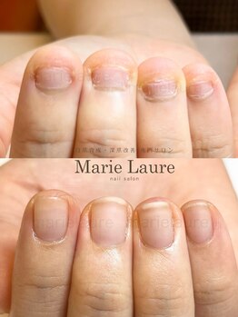 マリーロール 天王寺店(Marie Laure)/深爪矯正/自爪育成/ネイルケア